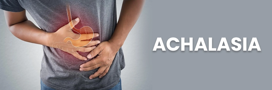 Achalasia: Know the Causes, Symptoms, and Treatment