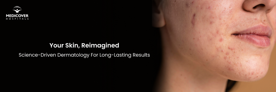 acne-pigmentation-treatment-bengaluru