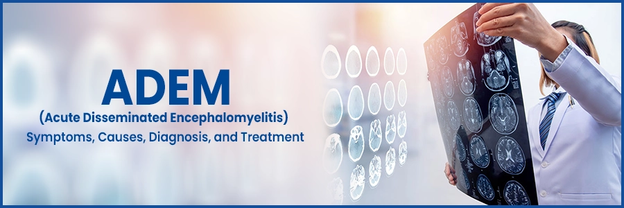 ADEM (Acute Disseminated Encephalomyelitis): Symptoms, Causes, Diagnosis, and Treatment