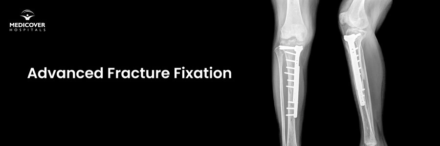 Advanced Fracture Fixation in Chandanagar | Complex Bone Injury Treatment