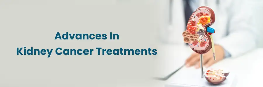 Advanced Kidney Cancer Treatments at Hyderabad Advanced Kidney Cancer Treatments at Hyderabad