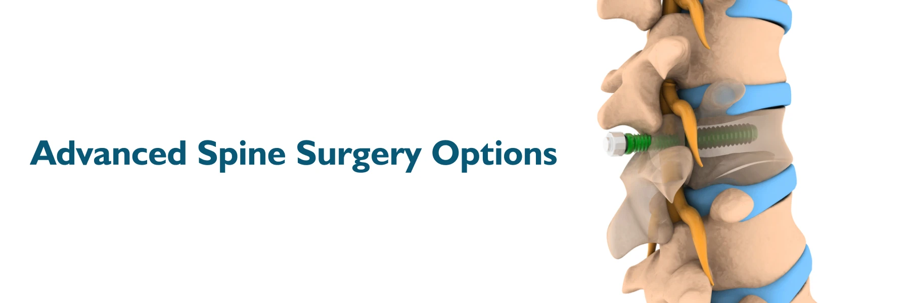 Advanced Spine Surgery Options in Navi Mumbai