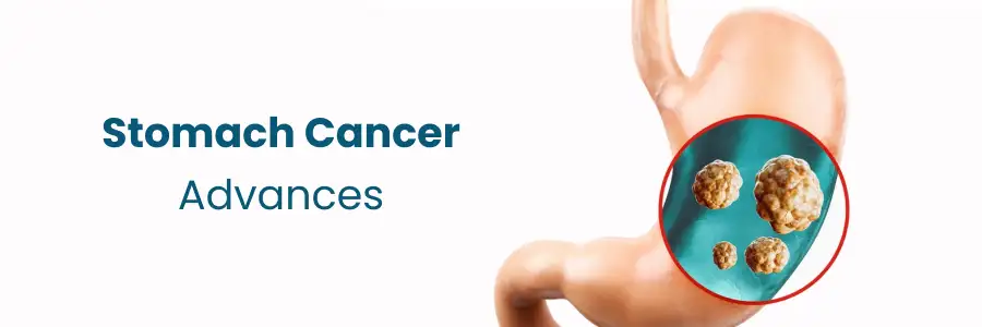 Advancements in Stomach Cancer Treatment in Vizag at Medicover Hospitals
