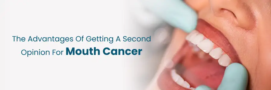 Advantages of a Second Opinion for Mouth Cancer