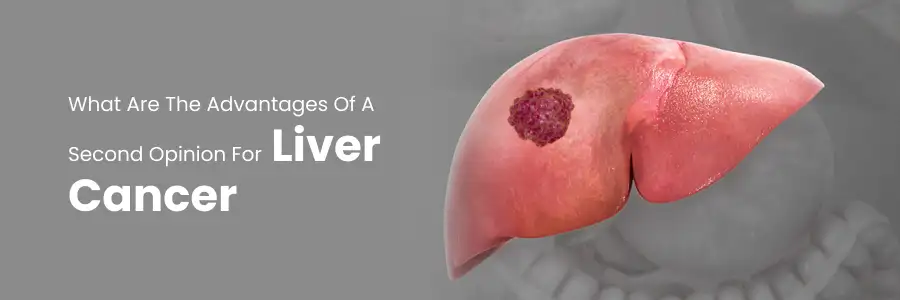 Advantages of Second Opinion for Liver Cancer