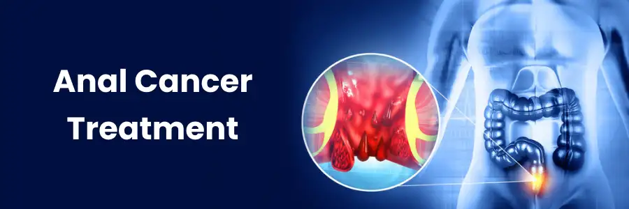 Anal Cancer Treatment in Hyderabad