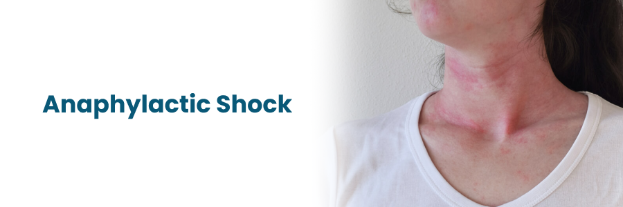 Anaphylactic Shock