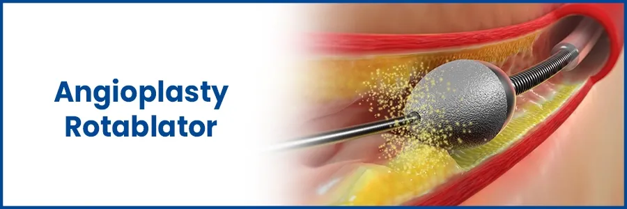 What is an Angioplasty Rotablator? What are the risks?