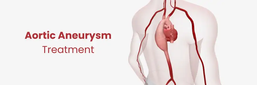 Aortic Aneurysm Treatment Begumpet