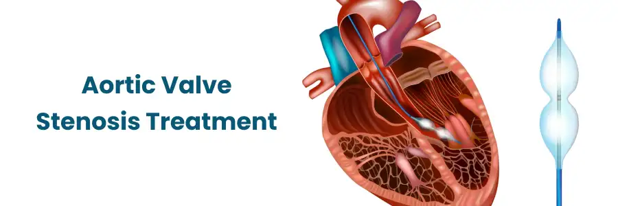 aortic valve stenosis treatment