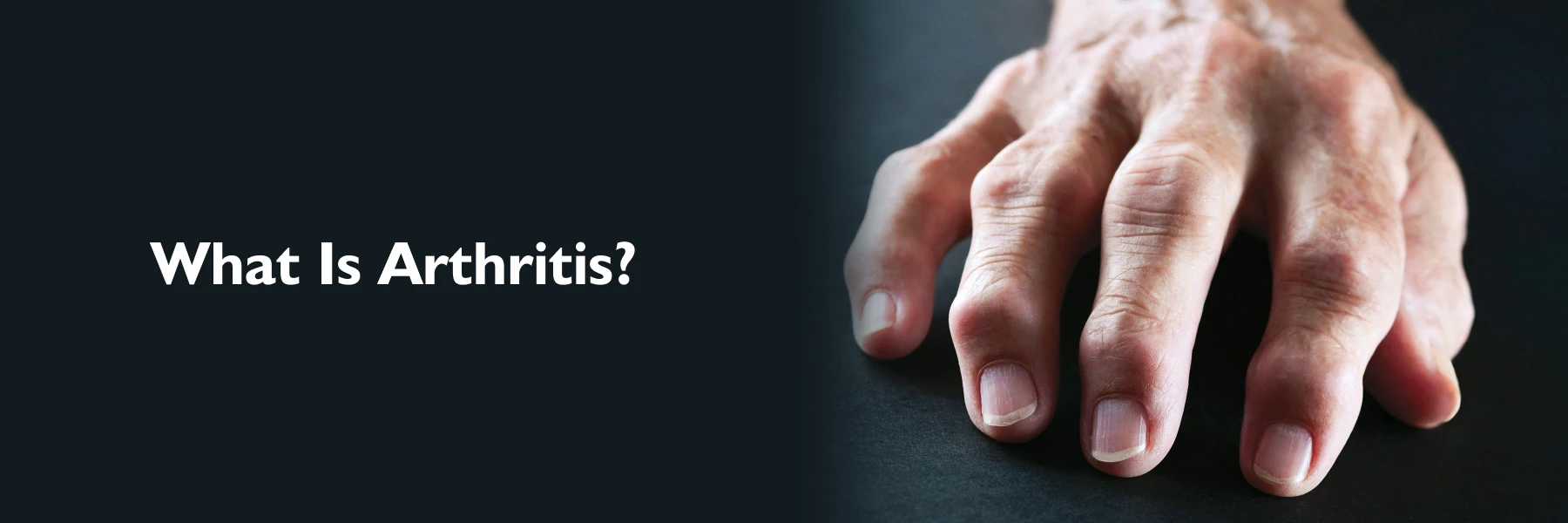 Arthritis