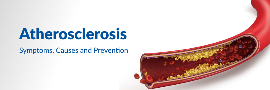Atherosclerosis Diet