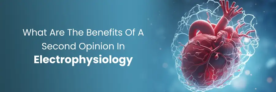 How a second opinion benefits electrophysiology treatments