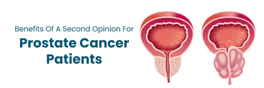 Benefits of a Second Opinion for Prostate Cancer
