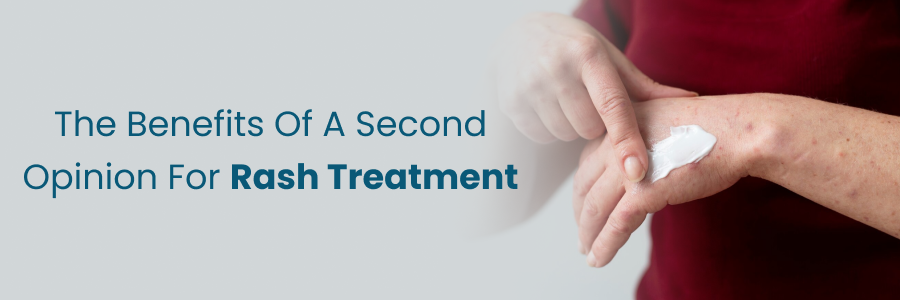 Second opinion benefits for rash treatment