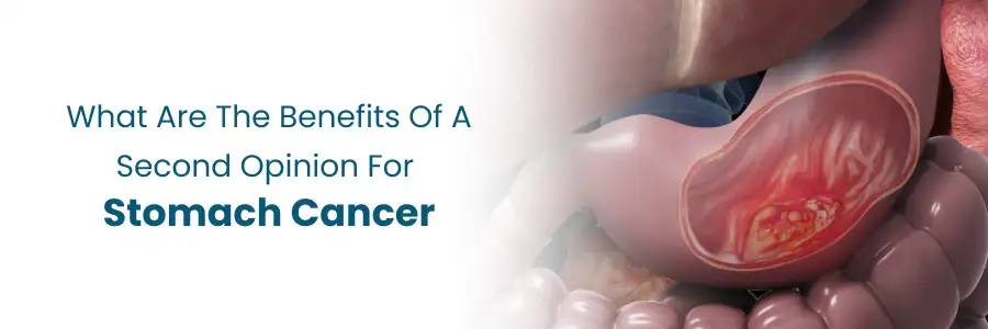Benefits of Second Opinion on Stomach Cancer