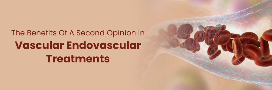 Endovascular second opinion benefits