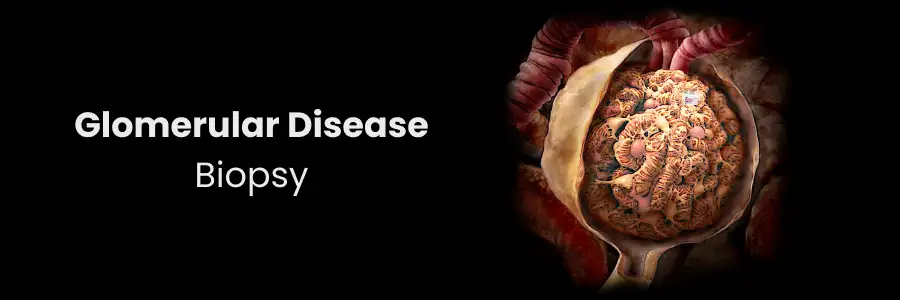 Biopsy in Diagnosing Glomerular Diseases

