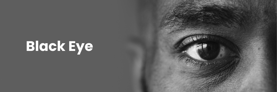 Black Eye