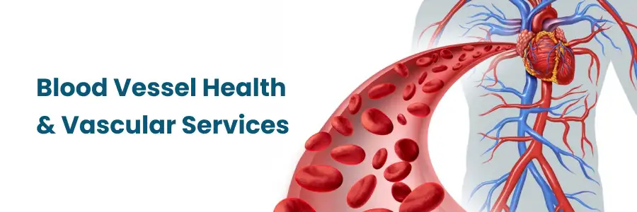 Best Blood Vessel Health and Vascular Services in Bangalore