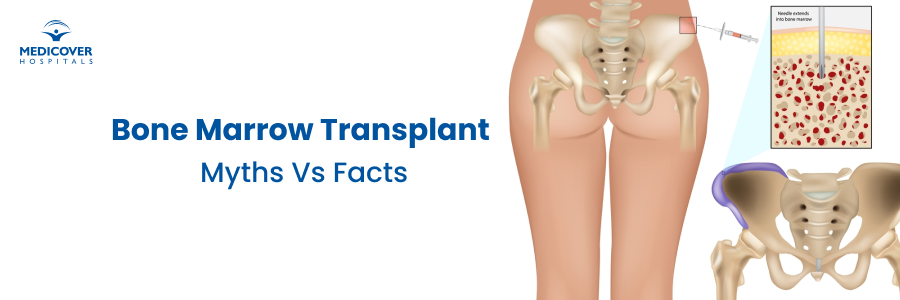 Bone Marrow Transplant Myths Bangalore Bone Marrow Transplant Myths Bangalore