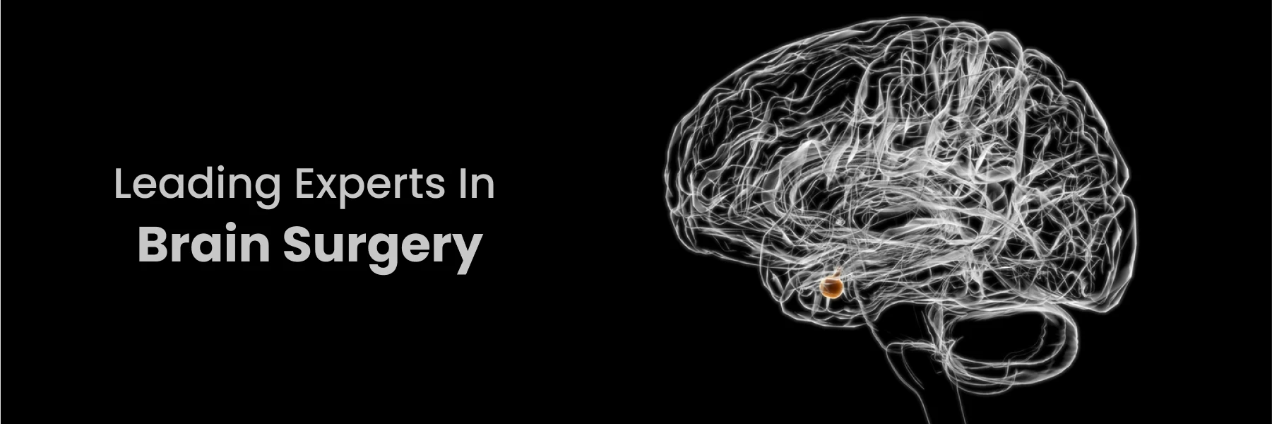 Brain Surgery Experts Hyderabad