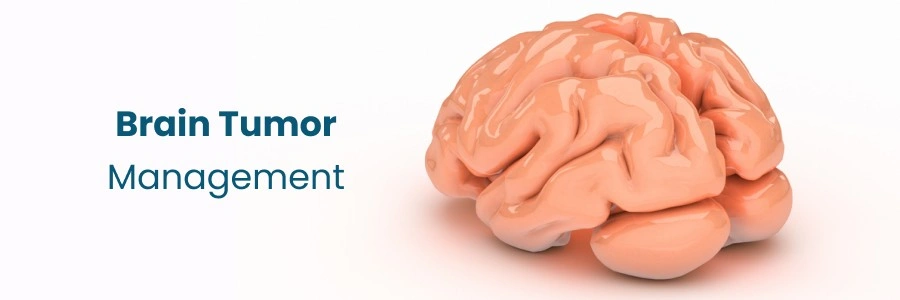 Top Strategies for Managing Brain Tumors