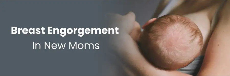 Breast Engorgement In New Moms