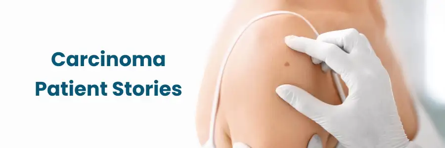 Carcinoma Patient Stories in Nellore Carcinoma Patient Stories in Nellore