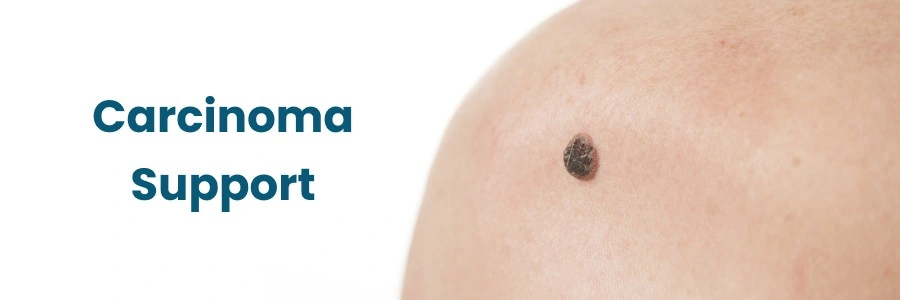 Carcinoma Support Hyderabad Carcinoma Support Hyderabad