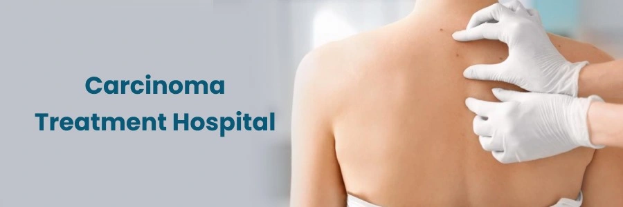 Carcinoma Treatment Hospital Near You Carcinoma Treatment Hospital Near You