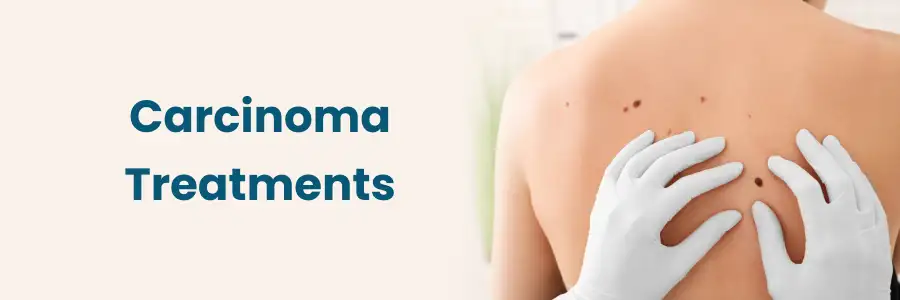 Carcinoma Treatments Hyderabad Carcinoma Treatments Hyderabad