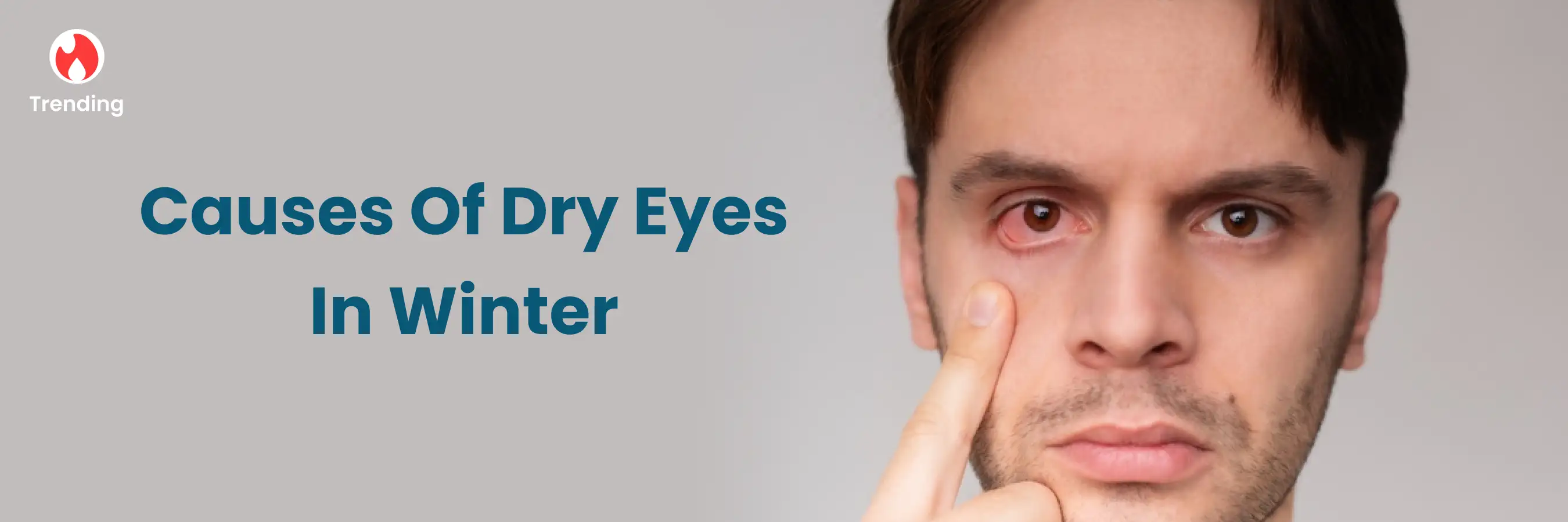 Winter Dry Eye Relief Guide