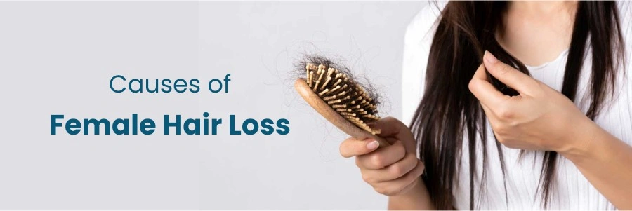 Causes of Female Hair Loss