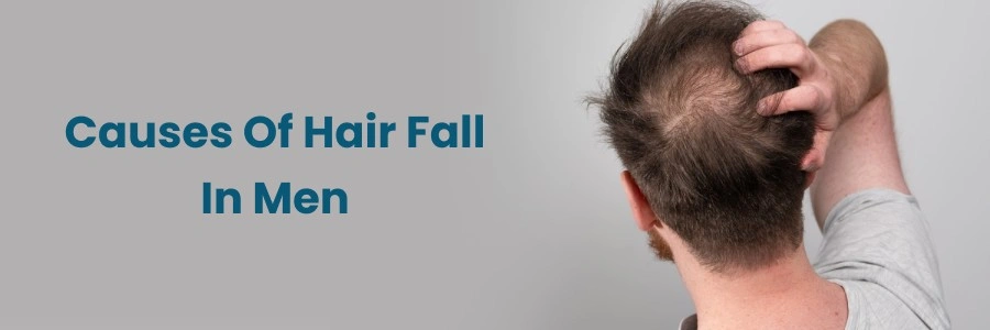 Male Hair Loss Causes & Prevention Guide