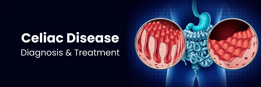 Celiac Disease Diagnosis and Treatment in Begumpet