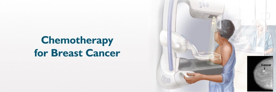 chemotherapy for breast cancer