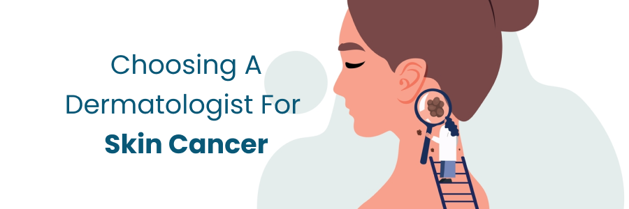 Choosing Dermatologist for Skin Cancer