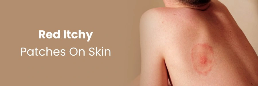 Managing Chronic Kidney Disease Naturally