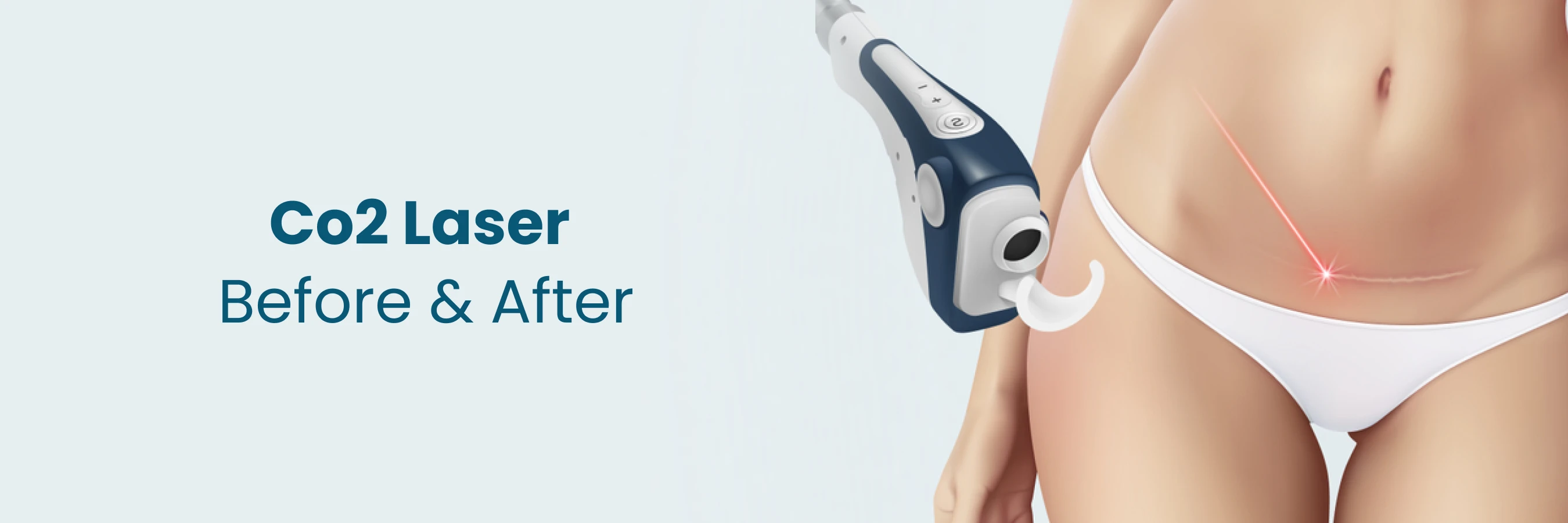 Co2 Laser Before and After