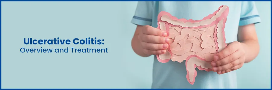 colitis treatment and overview
