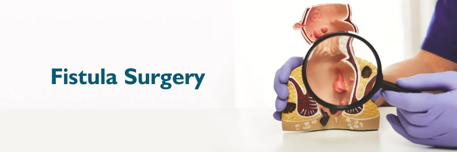 Optimal Exercise Timing for Lowering Colorectal Cancer Risk