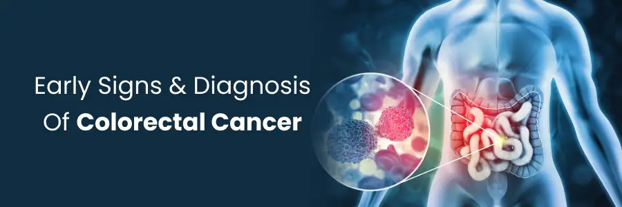Colorectal Cancer Early Signs and Diagnosis