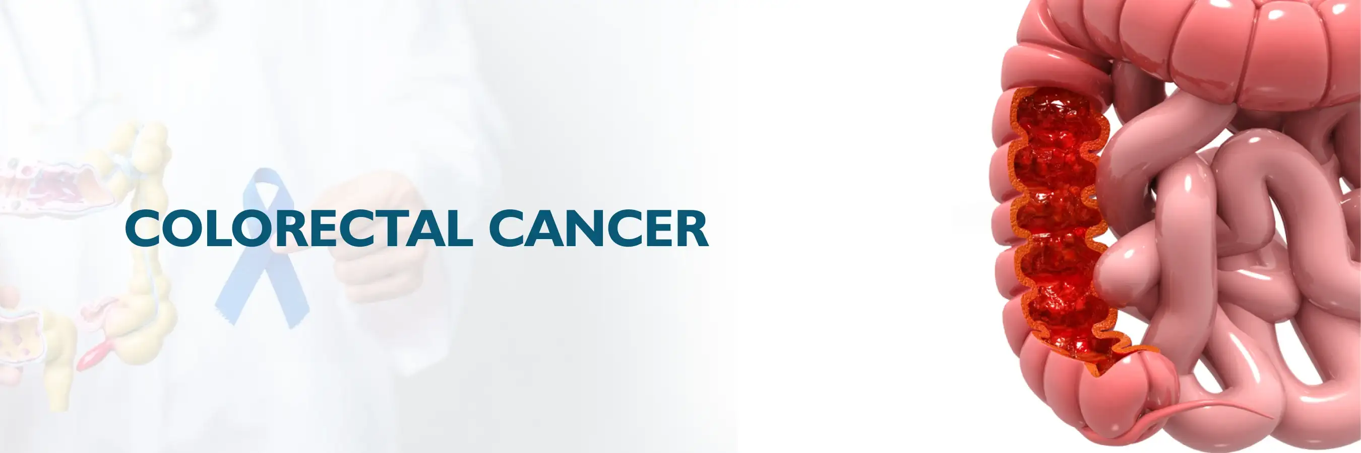 Colorectal Cancer: Prevention and Treatment is Possible!