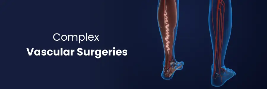 Complex Vascular Surgeries