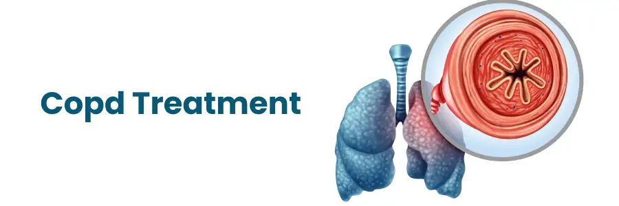 COPD Treatment in Begumpet