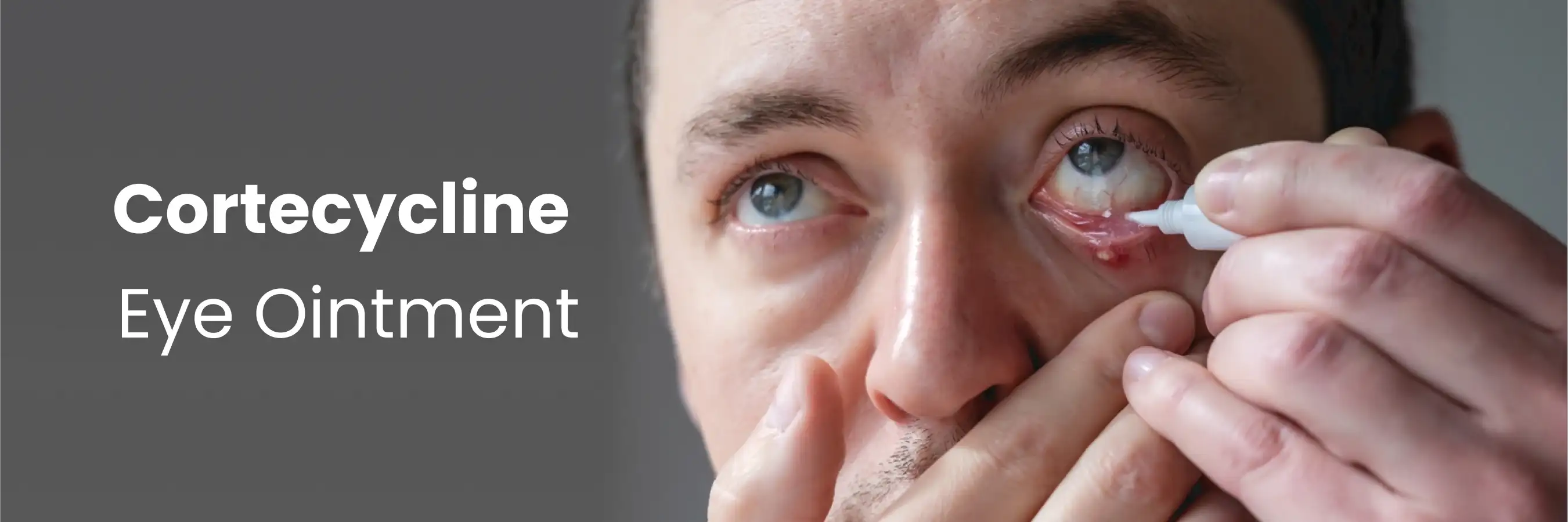  Cortecycline Eye Ointment