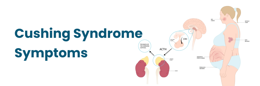 Cushing Syndrome Symptoms