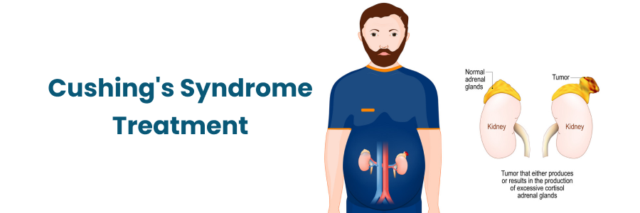 Cushing's Syndrome Treatment in Begumpet