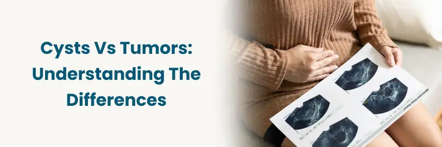 Cysts vs Tumors: Key Variances Explained